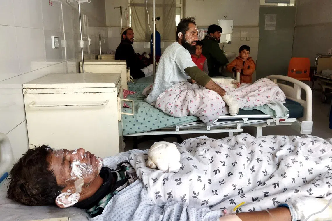 Afghan men suffering from burn injuries receive treatment at a hospital in Charikar city on Dec 18, 2022, after an oil tanker caught fire the night before at the Salang pass tunnel, about 90km north of the capital Kabul.