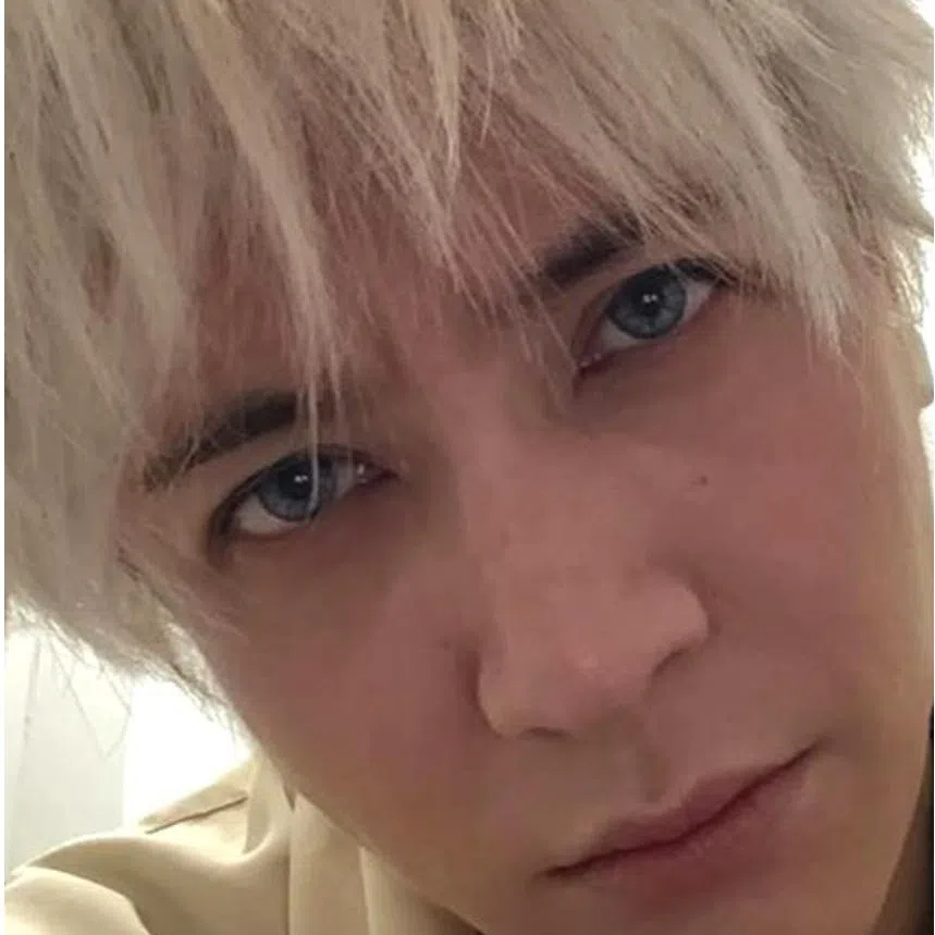 Joker Xue shared photos of his hair loss, with his legs covered in clumps of dyed hair.