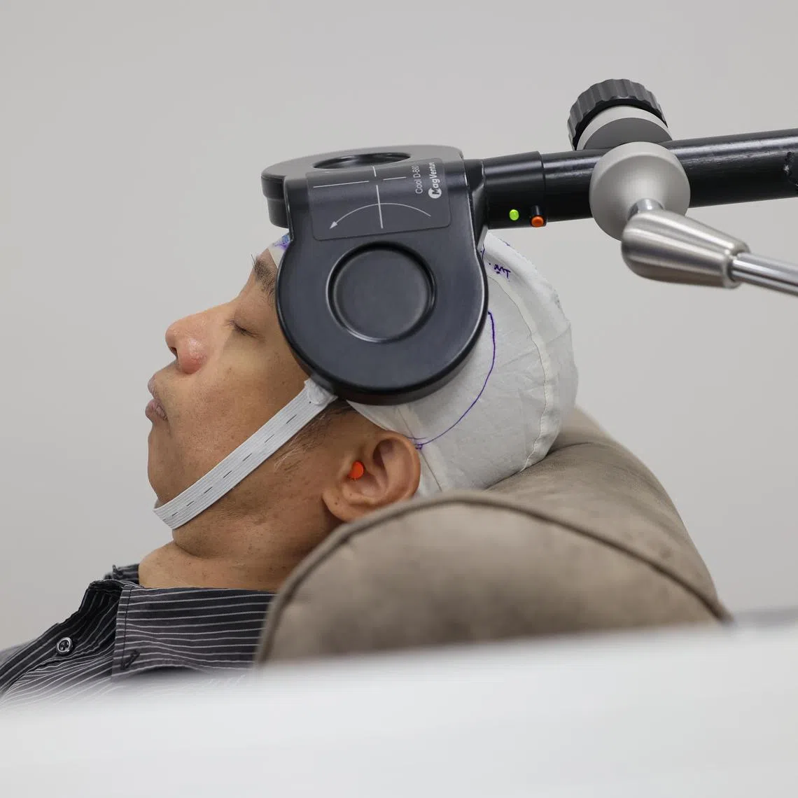 CMG20250808-RChiong01/张俊杰/赵世楚/KTPH Offers New Hope for Treatment-resistant Depression with Transcranial Magnetic Stimulation Therapy [Psychological Medicine Clinic, Admiralty Medical Centre, 676 Woodlands Drive 71 #03-01 Kampung Admiralty Singapore 730676]
Mr Ng Chee Hiong undergoing a brain stimulation therapy session with the Transcranial Magnetic Stimulation (TMS), seen during a therapy session at the Psychological Medicine Clinic in the Admiralty Medical Centre on Aug 8, 2025.