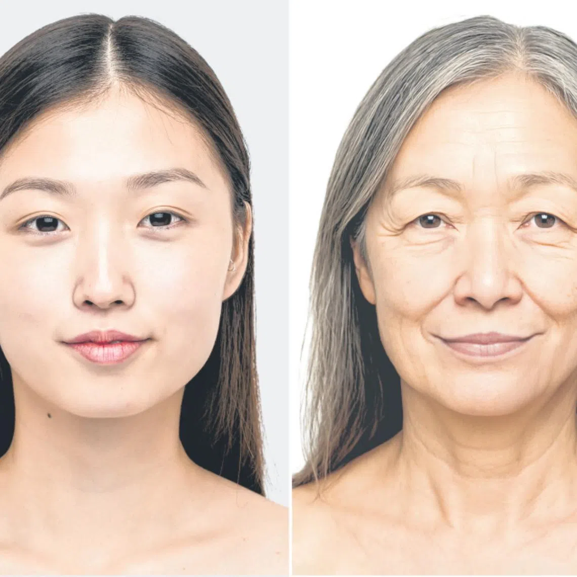 Facial ageing occurs at every level, from bone and muscle to fat and skin, and is influenced by both genetics and lifestyle.