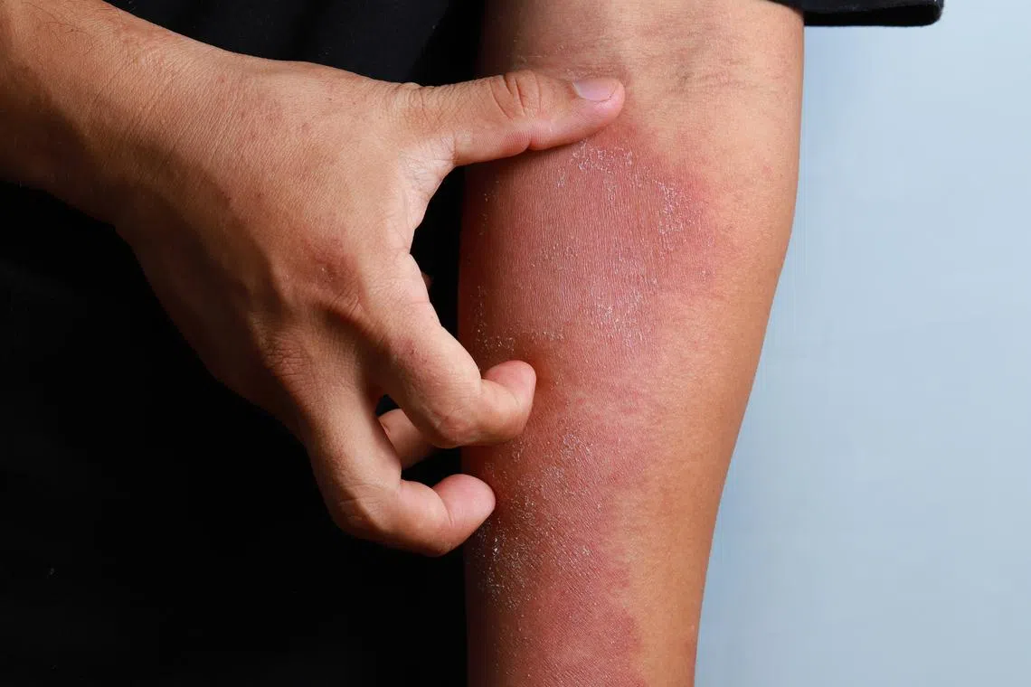 Visible skin conditions can cause deep mental distress, especially among young patients, says the writer.