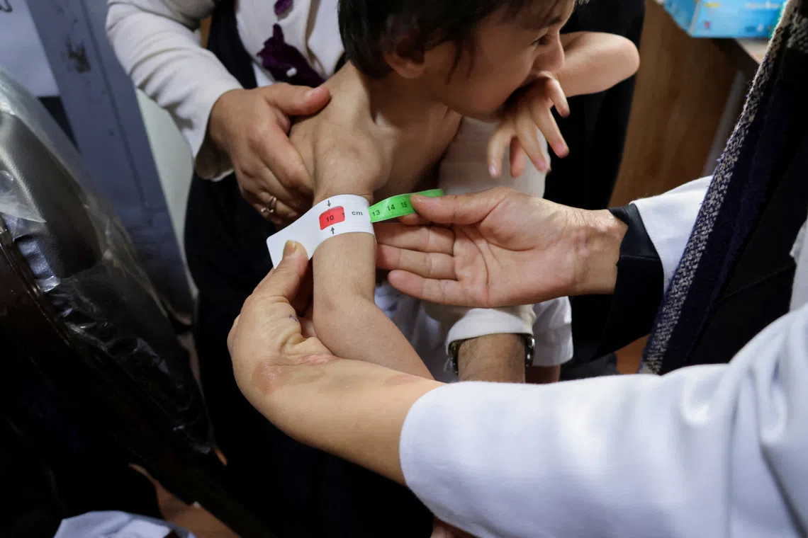 FILE PHOTO: A doctor measures the upper arm of a three-year-old boy suffering from severe acute malnutrition, at Yaka Dokan health clinic, Herat, Afghanistan, October 23, 2024. REUTERS/Charlotte Greenfield/File Photo