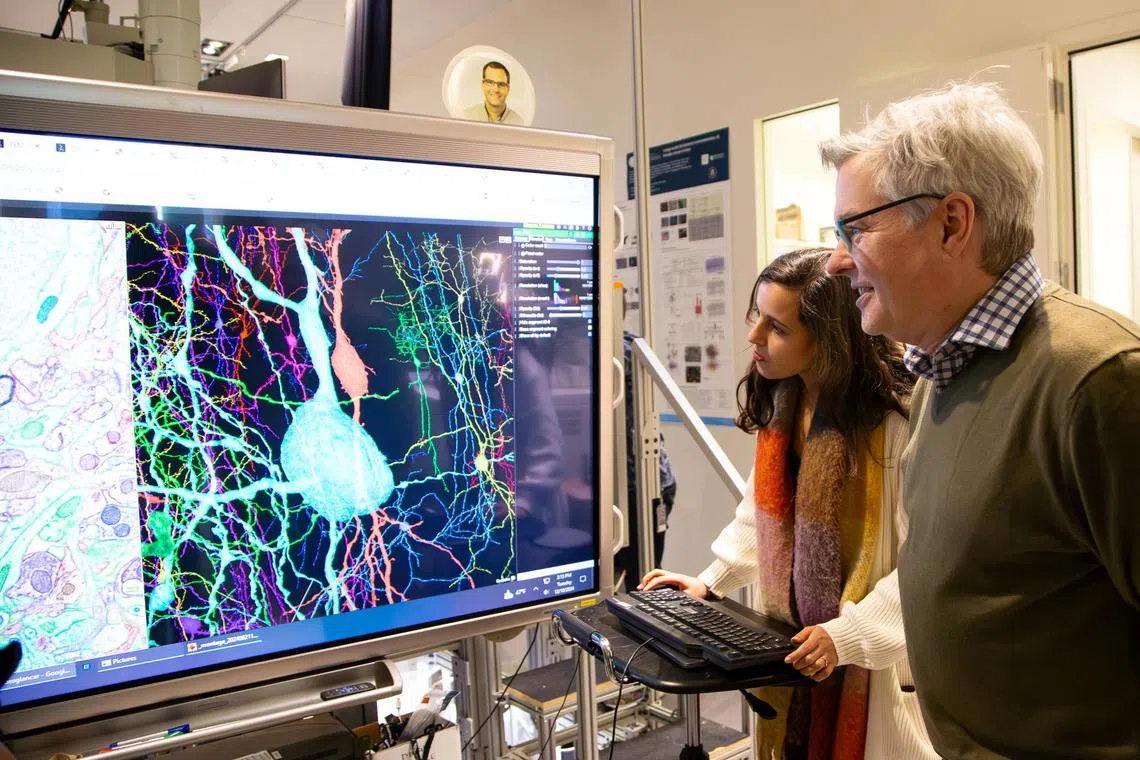 In all, they collected data that covers about 5.4km of neuronal wiring in a part of the brain that processes visual information from the eyes.