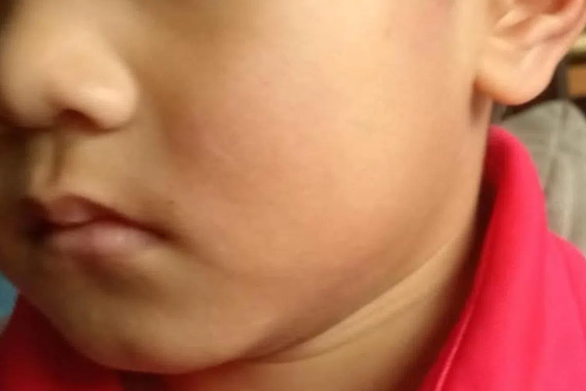 The boy was allegedly slapped after showing his middle finger during a game of catching. 