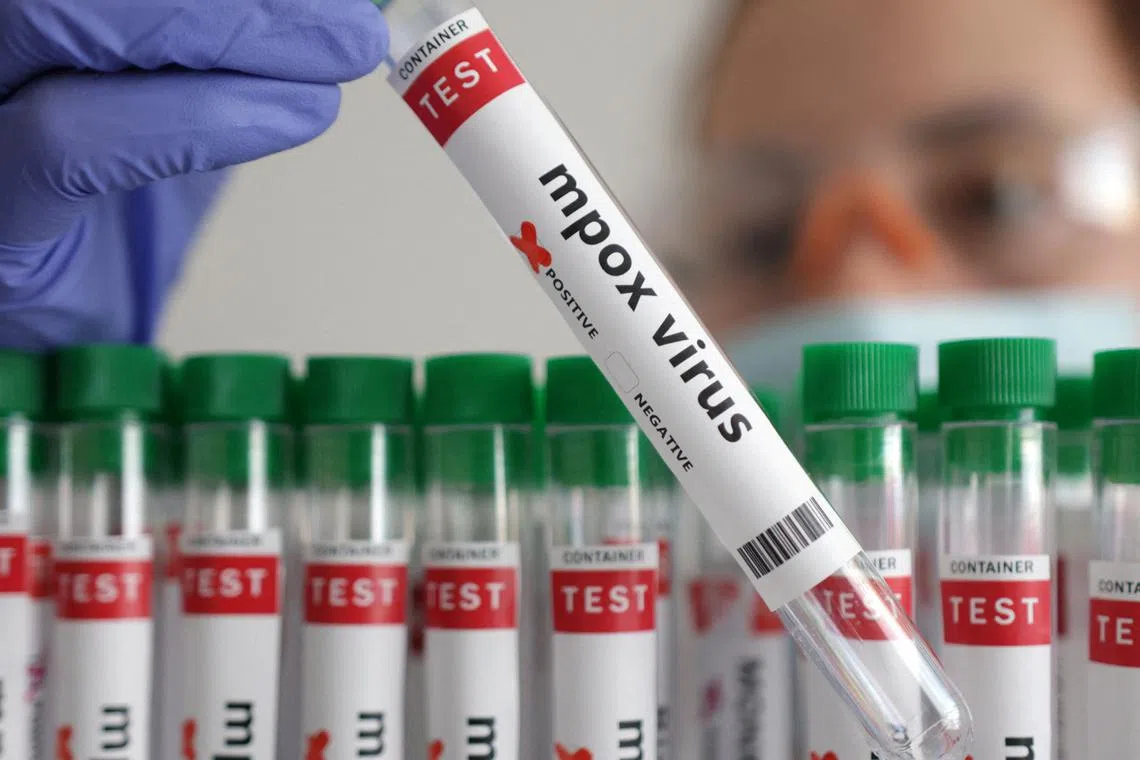 FILE PHOTO: A test tube labelled \"Mpox virus positive\" is held in this illustration taken August 20, 2024. REUTERS/Dado Ruvic/Illustration/File Photo