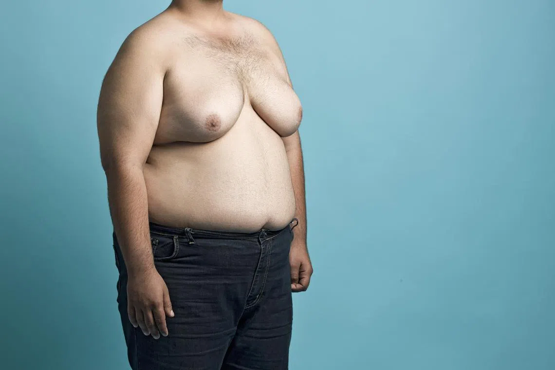 Obese young man. For