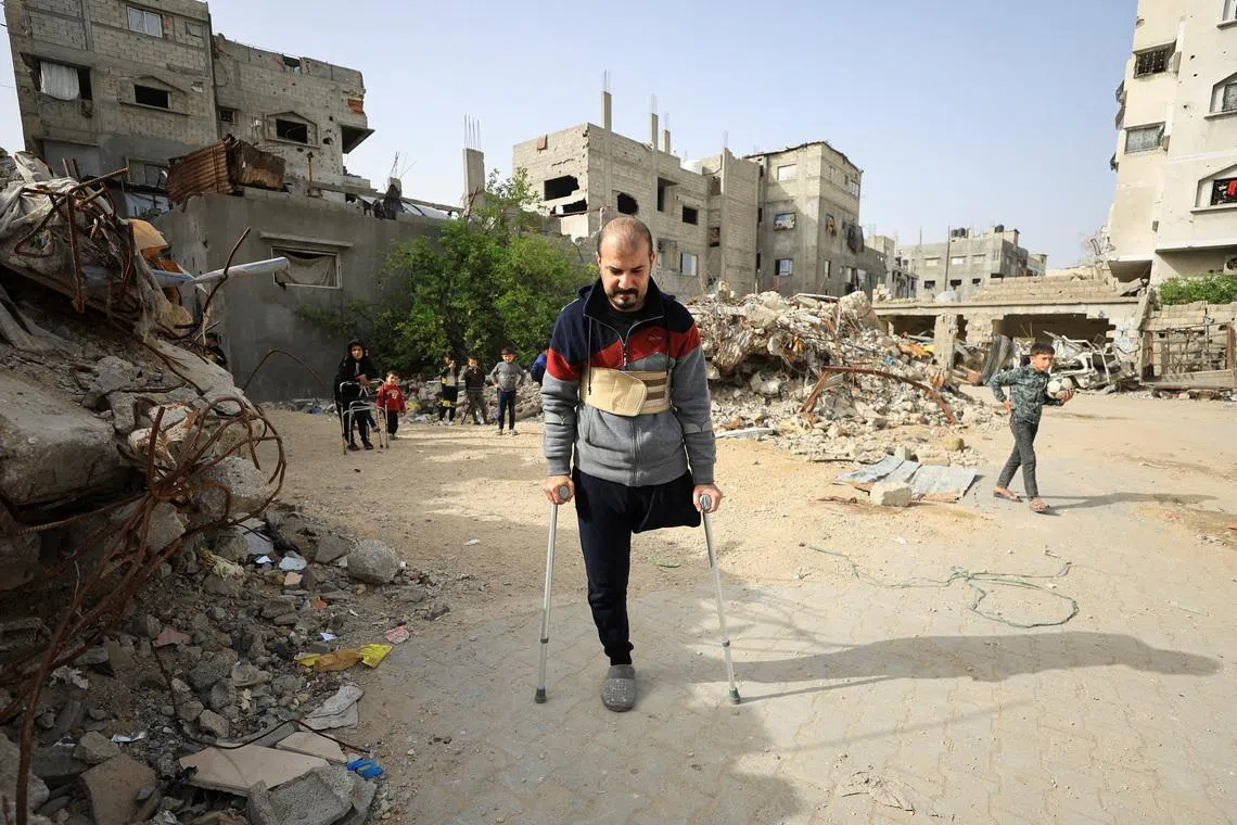Gaza's war amputees short of prostheses under Israeli restrictions