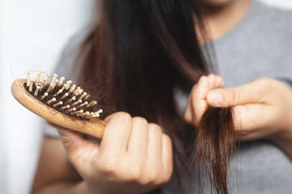 Factors like genetics, lifestyle and scalp health can contribute to hair loss, says Svenson’s group chief trichologist Kim Fong.