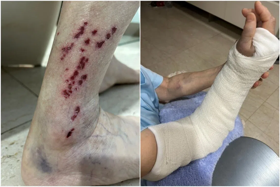 Ms Michelle Ng's 79-year-old father (left) and 77-year-old mother are two of the injured commuters.