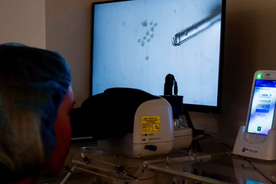 Sperm samples seen through STAR (Sperm Tracking and Recovery) technology at Columbia University Fertility Center in New York on Aug 7.