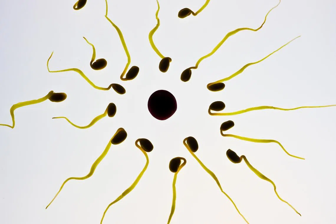 More men are now seeking a surgical procedure to cut or seal the tubes carrying their sperm.