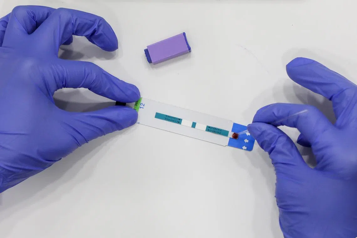 Globally, the prevalence of Aids among people aged 15 to 49 is 0.8 per cent.