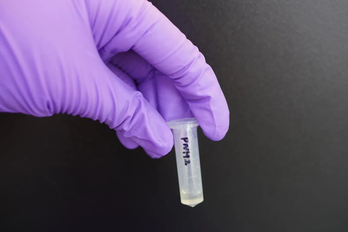 COE-PNH2, the molecule designed by the I-FIM researchers, has shown high efficacy against Mycobacterium abscessus, one of the most prevalent mycobacterial species.