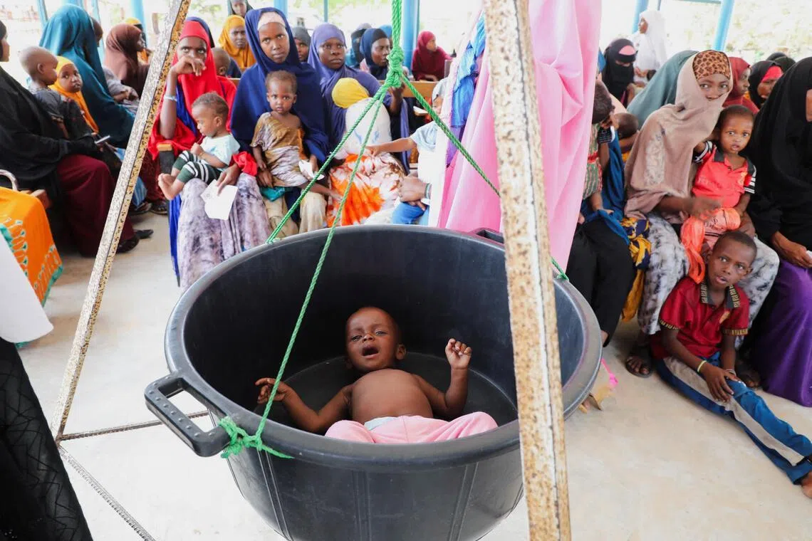 A Somali child is screened for malnutrition at a hospital in Mogadishu, Somalia.

