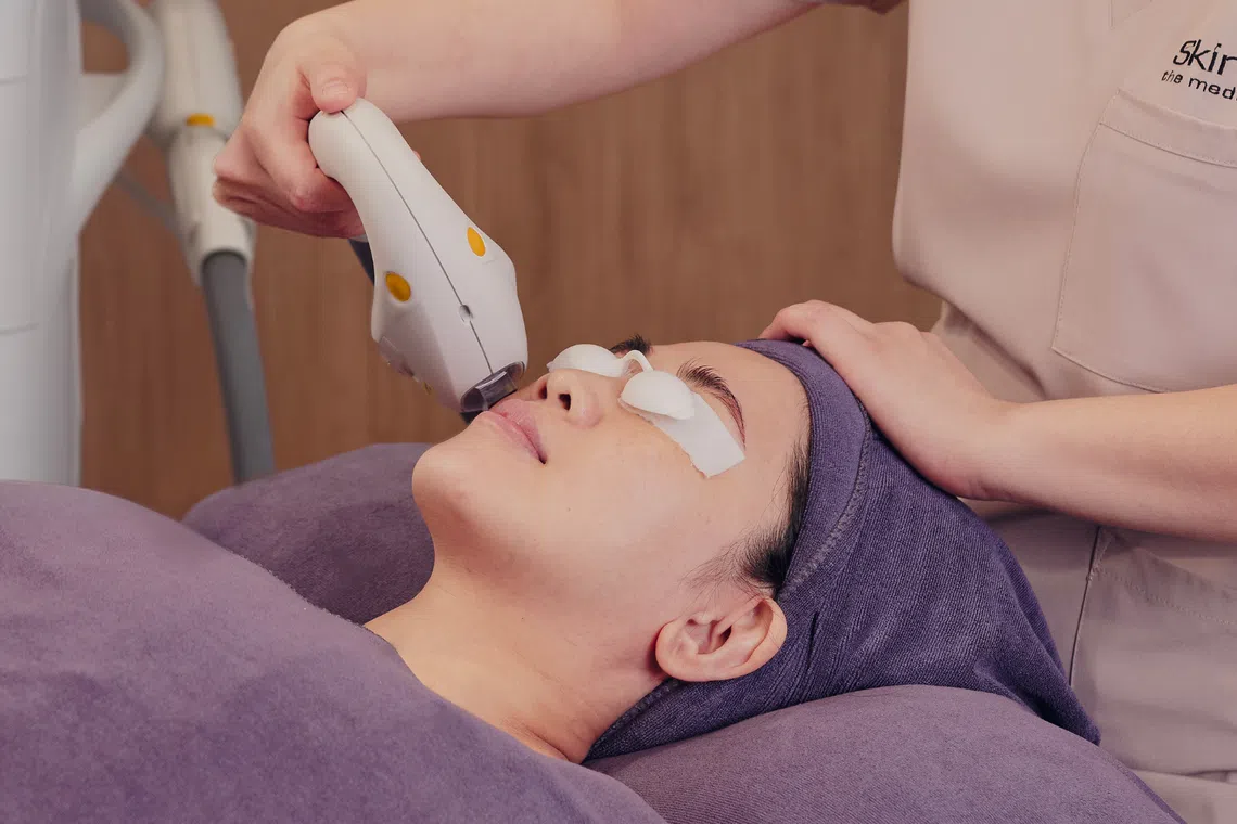 stellar m22 treatment improve skin tone texture skinlab