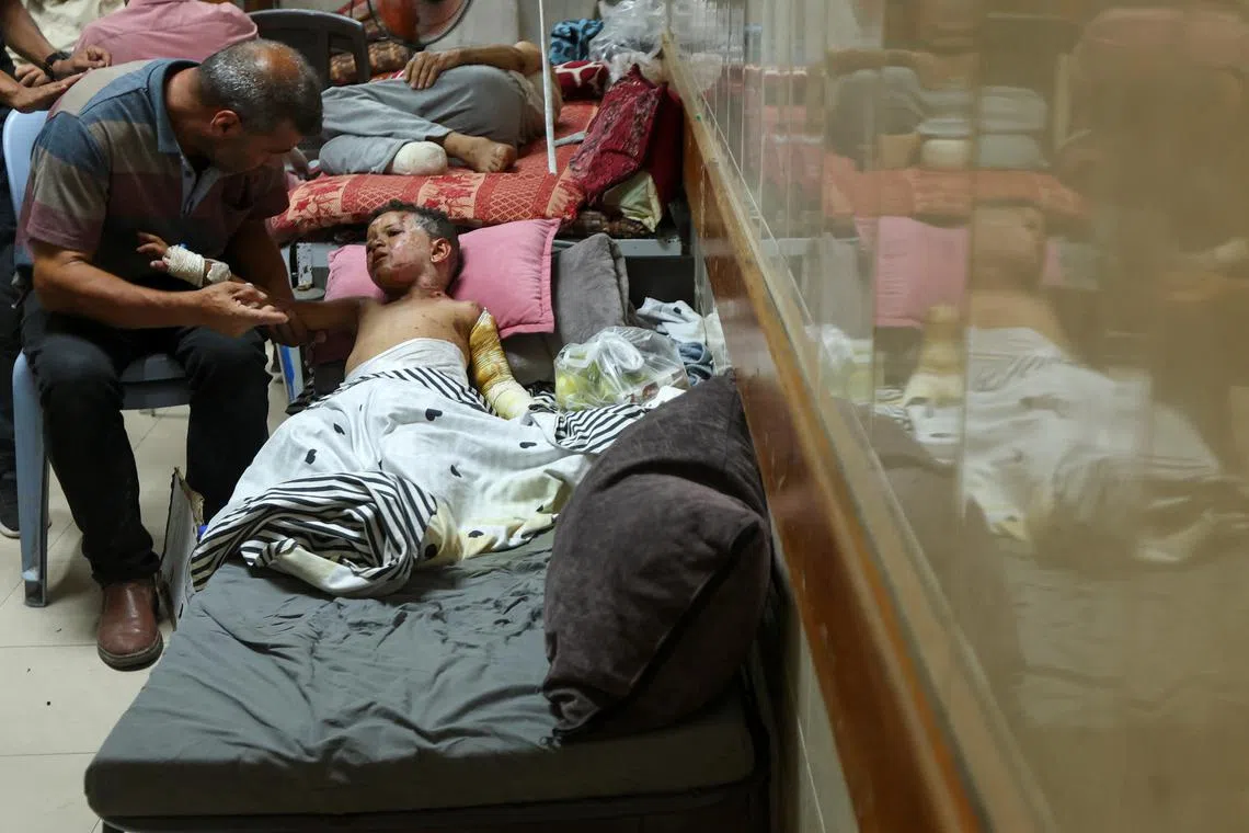 FILE PHOTO: Palestinian boy Mahmoud al-Saafin, who suffers from burns caused by an Israeli strike, according to medics, is tended to by his father at Al-Aqsa Martyrs Hospital in Deir Al-Balah in the central Gaza Strip, July 16, 2024. REUTERS/Ramadan Abed/File Photo