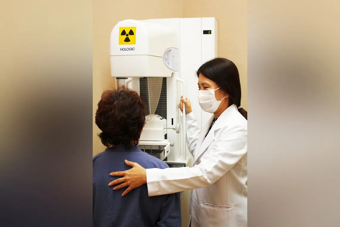 A woman undergoing a mammogram screening. Experts say the most common types of cancer include breast, ovarian and colorectal.
