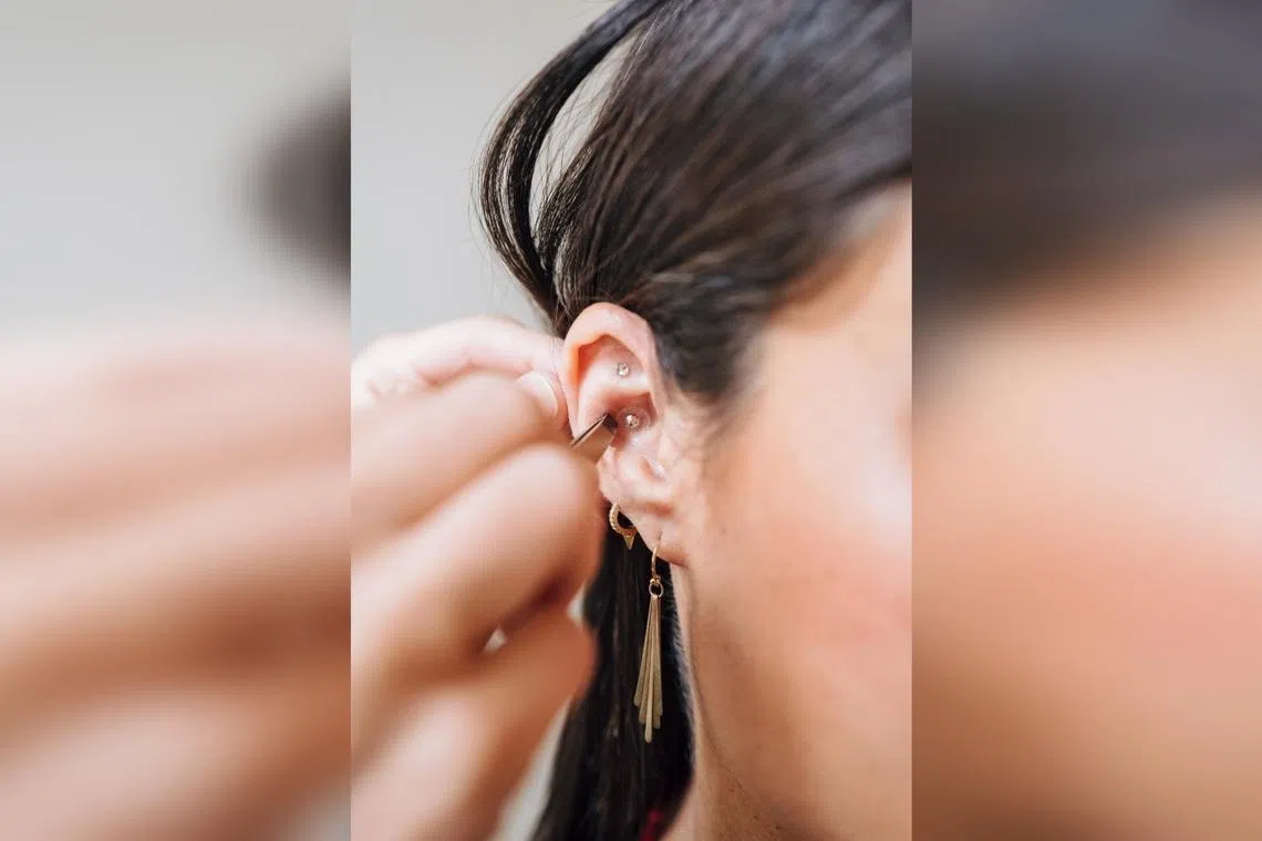 Acupuncturists have traditionally used the Vaccaria plant’s black seeds as ear seeds, with newer versions being flashier.