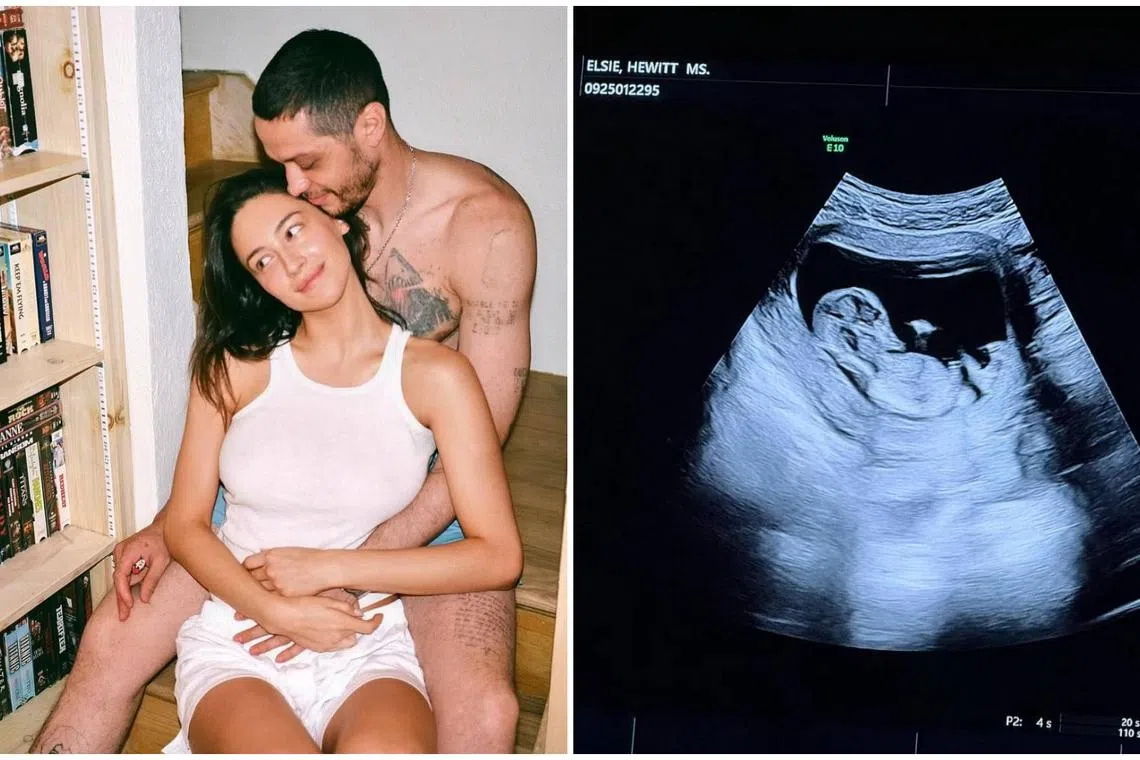 American comedian Pete Davidson and British model Elsie Hewitt announced the pregnancy on July 17.