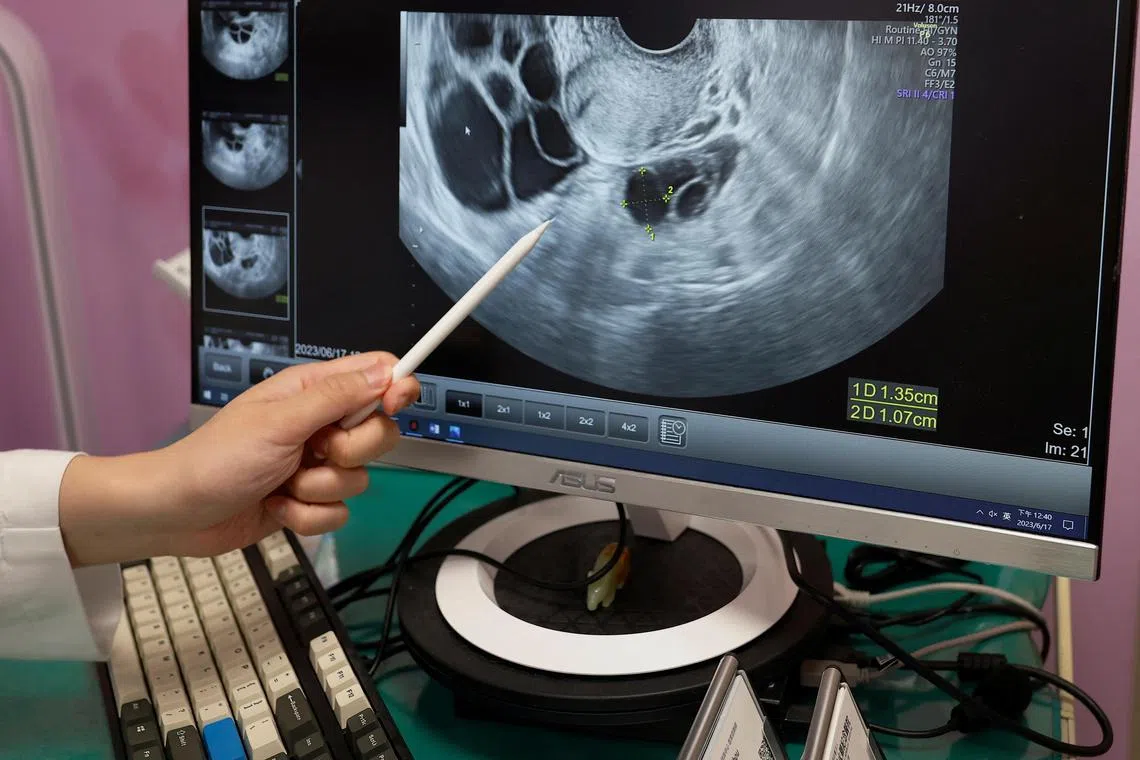 There are hopes the law would be expanded to allow the eggs to be used by unmarried women and same-sex married couples.