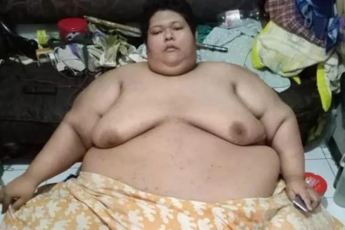 Muhammad Fajri died from a severe infection in his leg after his weight disrupted his body’s metabolism.