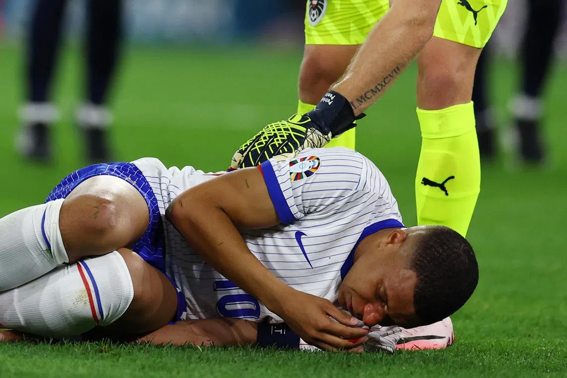Soccer Football - Euro 2024 - Group D - Austria v France - Dusseldorf Arena, Dusseldorf, Germany - June 17, 2024 France's Kylian Mbappe reacts after sustaining an injury REUTERS/Kacper Pempel