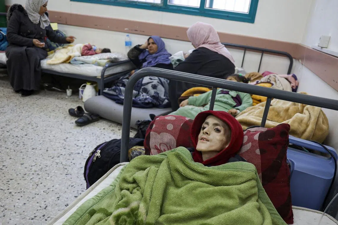A February 2024 photo shows 10-year-old cerebral palsy sufferer Yazan Kafarneh in a hospital bed in Rafah. He died on March 4.