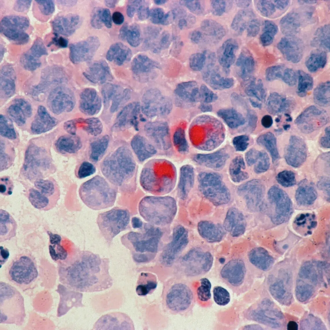 Researchers found people on vegetarian diets had a lower risk of five cancers compared with their meat-eating counterparts.