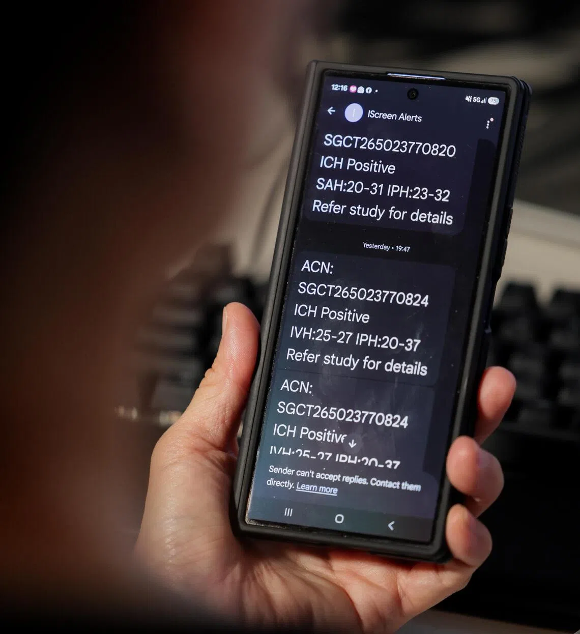 For scans which had been detected as positive for bleeding by the AI model, the system will automatically send off an SMS message to both the radiologist and attending doctor to alert them.