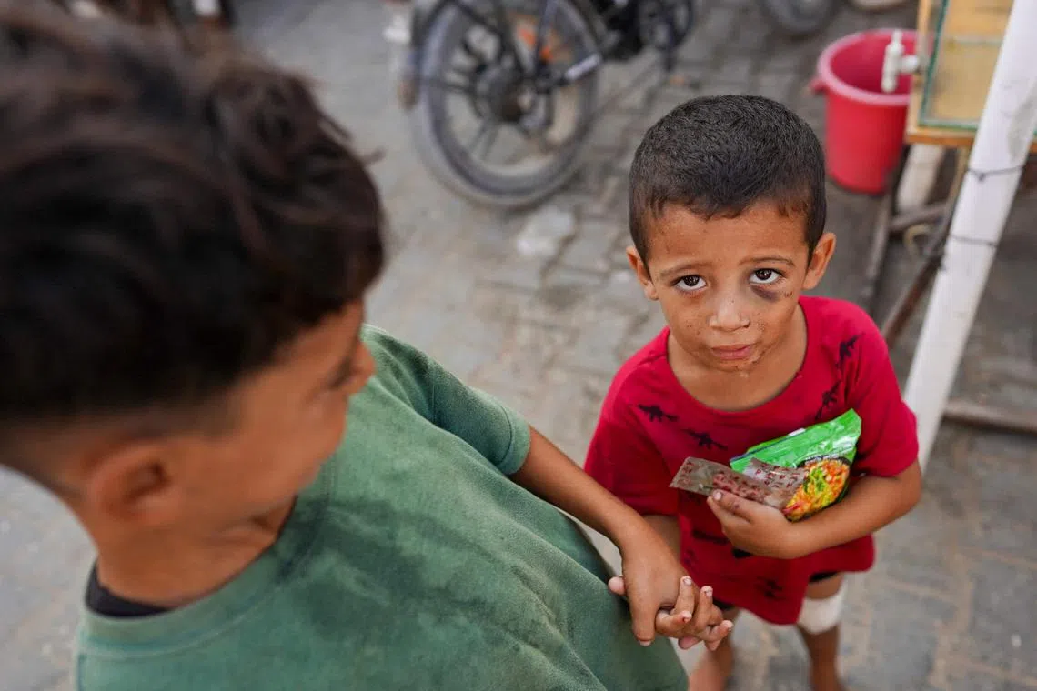 An injured child holds food as he poses for a picture in Khan Yunis, on the southern Gaza Strip on Aug 15.