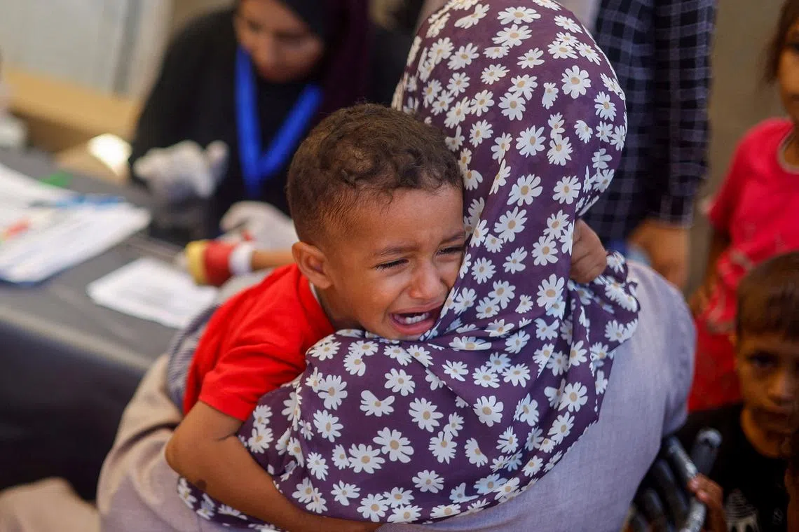 FILE PHOTO: A malnourished Palestinian baby is held while receiving treatment at the International Medical Corps field hospital, amid the Israel-Hamas conflict, in Deir Al-Balah in the southern Gaza Strip, June 22, 2024. REUTERS/Mohammed Salem/File Photo
