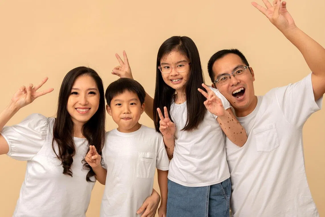The rare condition Charlotte Lim has is not inherited. She is seen here with mum Esther Zheng, brother Keefe Lim and dad Lim Wei Liang.