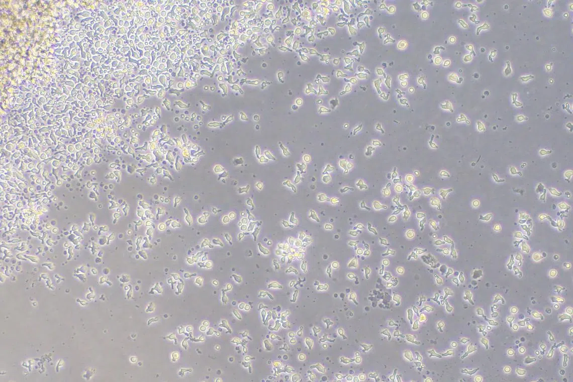 T-cells used in CytoMed's new allogeneic CAR-T therapy.