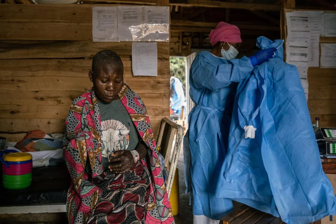 A patient with mpox waits for treatment at the Kavumu hospital in Kabare territory, South Kivu region, Democratic Republic of Congo, on Sept 3.