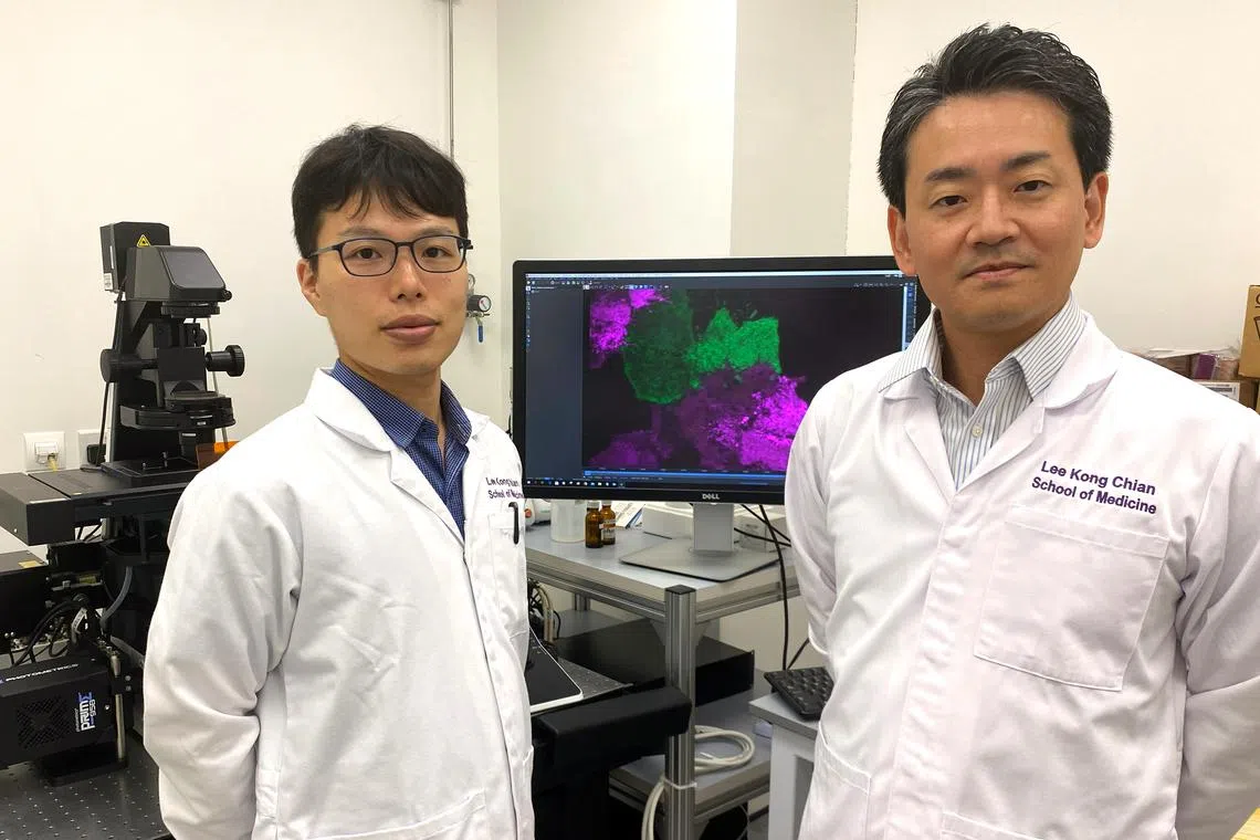 Dr Tomoki Naito (left), research fellow from NTU's Lee Kong Chian School of Medicine and Associate Professor Yasunori Saheki with a microscopy image showing changes in cholesterol distribution in a cell.