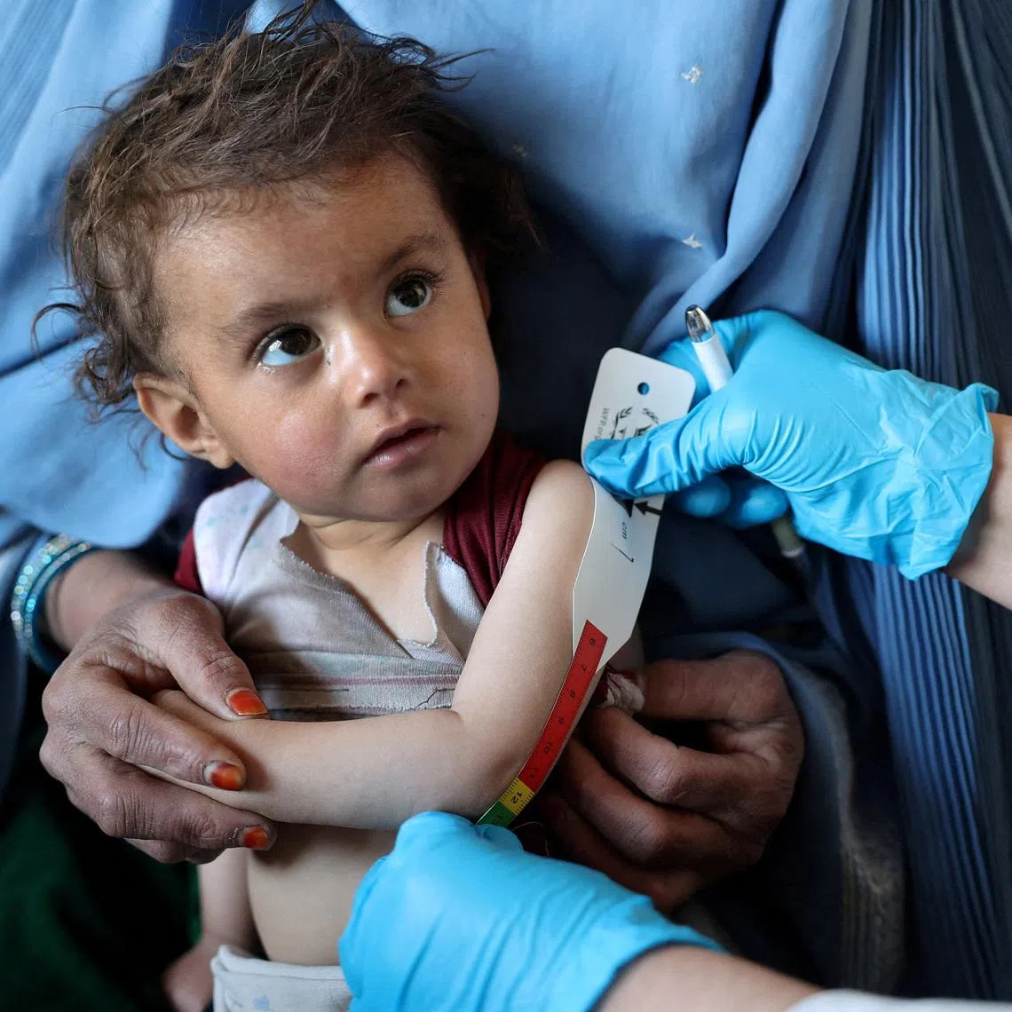 An Afghan girl looks at the doctor as he measures her upper arm at the WFP-supported Qasaba Clinic, after an increase in malnutrition cases following the return of deported Afghans, in Kabul, Afghanistan, January 7, 2026. REUTERS/Sayed Hassib     TPX IMAGES OF THE DAY