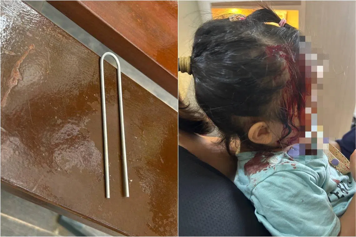 The blow from the 10cm-long U-bar (left) left the girl with a 1cm by 1.2 cm head wound that was sealed with tissue adhesive. 