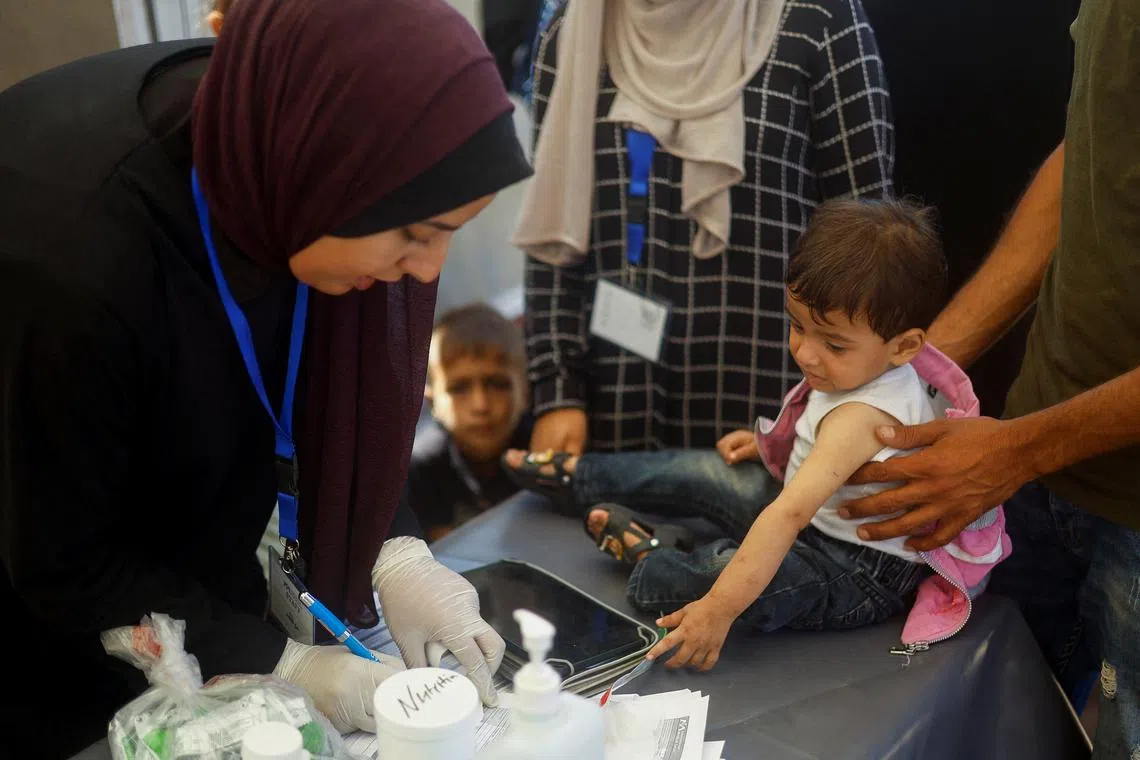 A malnourished Palestinian boy receives treatment at the International Medical Corps field hospital, amid the Israel-Hamas conflict, in Deir Al-Balah in the southern Gaza Strip, June 22, 2024. REUTERS/Mohammed Salem