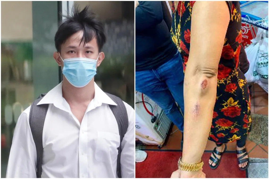 Wong Xing Fong attacked Madam Hindocha Nita Vishnubhai near Northvale condominium in Choa Chu Kang in May 2021