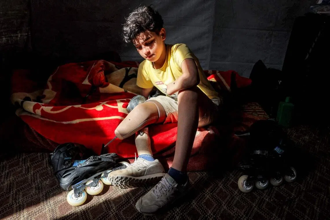 Akram al-Fayoumi, a 13-year-old Palestinian amputee, sitting on his bed with his prosthetic leg and rollerblades at a shelter in Gaza City on May 13. Al-Fayoumi lost his right leg and left hand due to reported Israeli bombardment on the Abdel Fattah Hammoud School in the Tuffah neighbourhood of Gaza City on Aug 8, 2024. 
