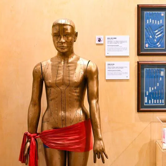 Acupuncture as traditionally practised as seen here in a life-size acupuncture model and needles on display at Singapore Chinese Cultural Centre. 