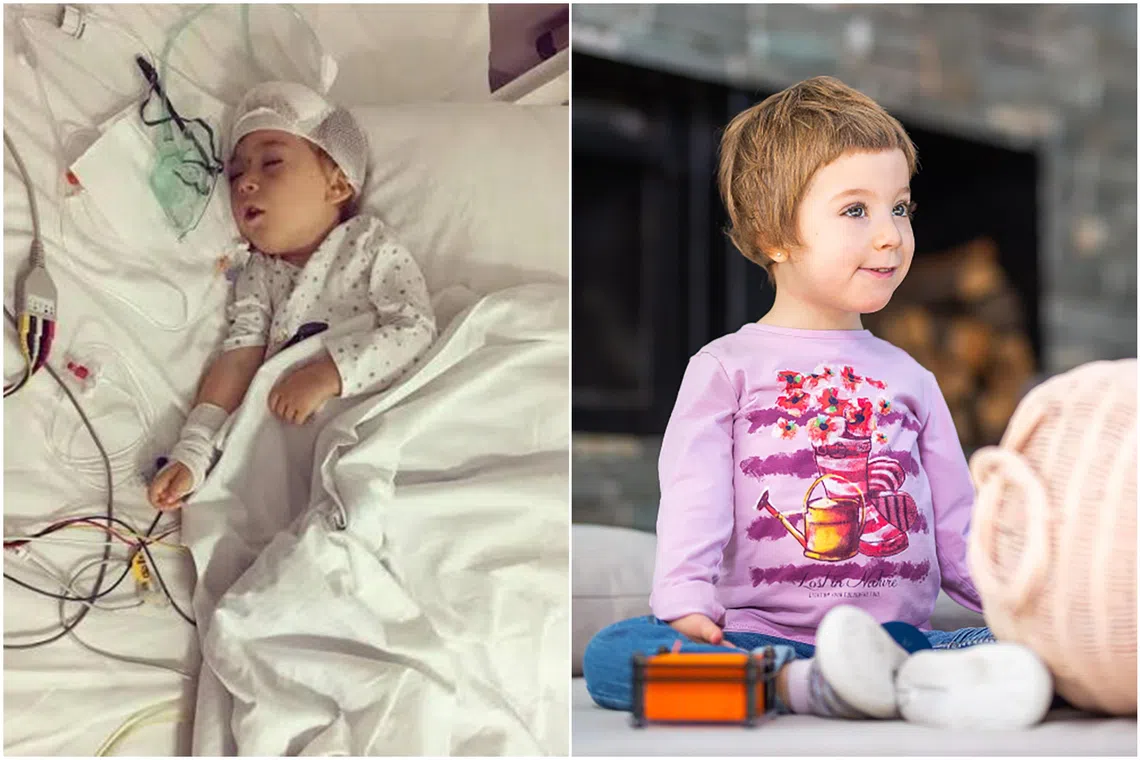 Spanish girl Irai, who was diagnosed with aromatic amino acid decarboxylase deficiency, after the treatment (right) when she was seven years old.