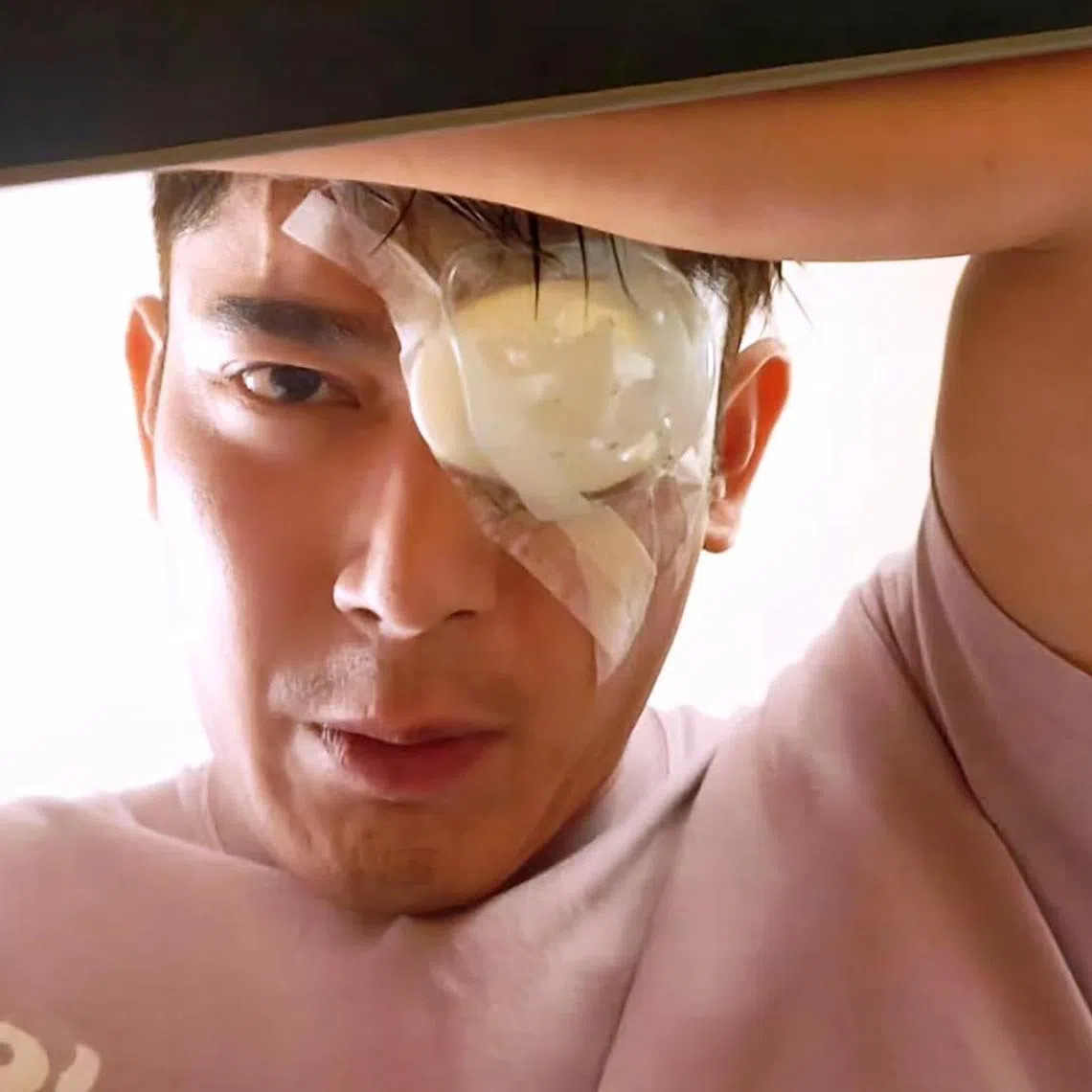 Elvin Ng shares a photos of himself on the operating table with his doctors (left) and with his eye patched up as he prepared to be discharged.