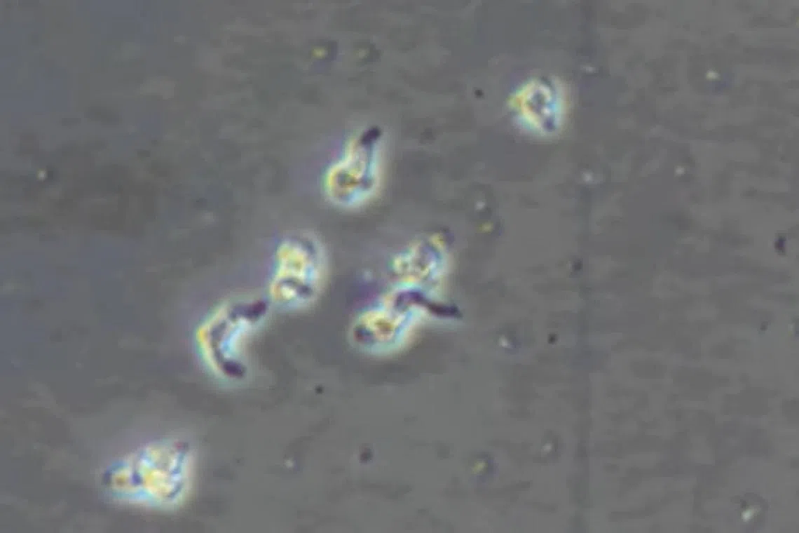 Naegleria fowleri is an amoeba that lives in soil and warm freshwater across the globe.