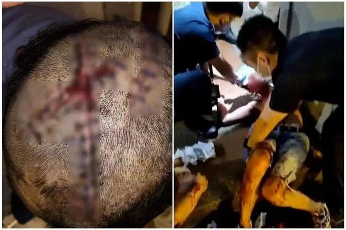 Mohamad Amirul Shafi Abdullah slashed a man with a knife at Clarke Quay in March 2022 over a purported staring incident.