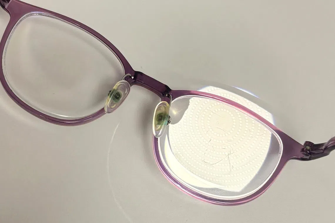 Children with high myopia face an increased risk of eye diseases such as cataracts and glaucoma in adulthood.