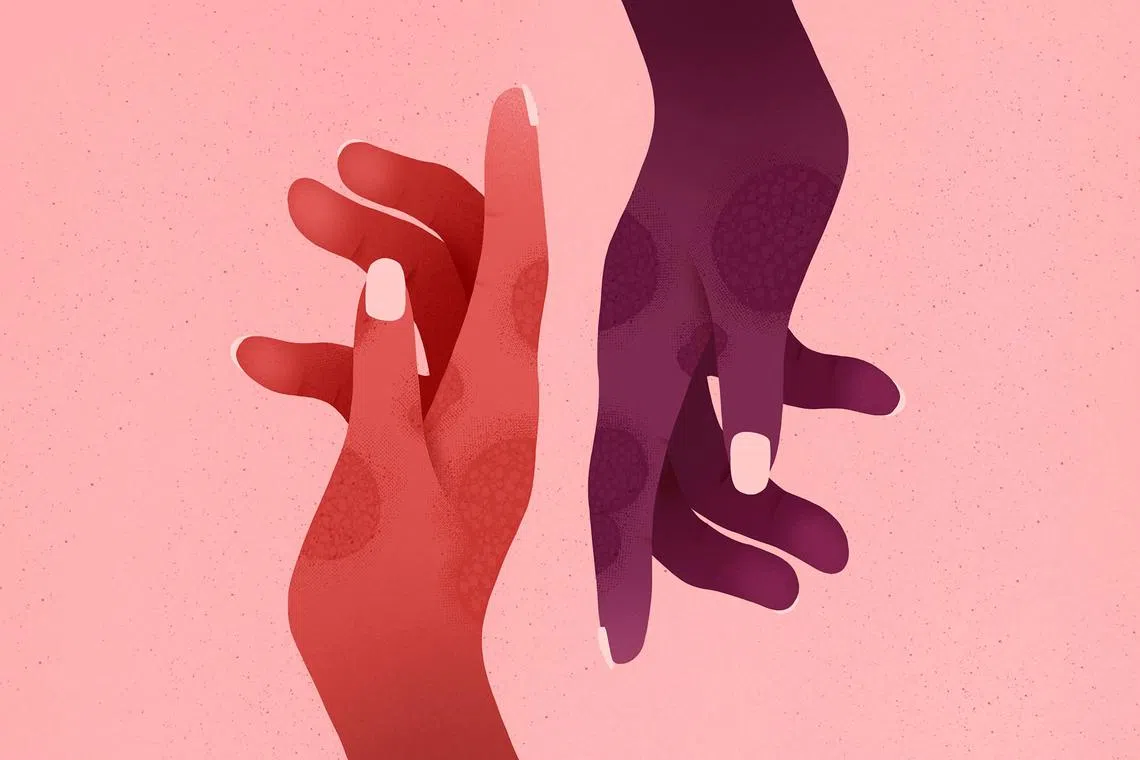 It is not completely clear what causes atopic dermatitis, but there are several factors in play.