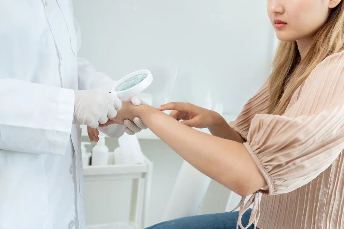 dermatologist checking patient hand for signs of atopic dermatitis eczema