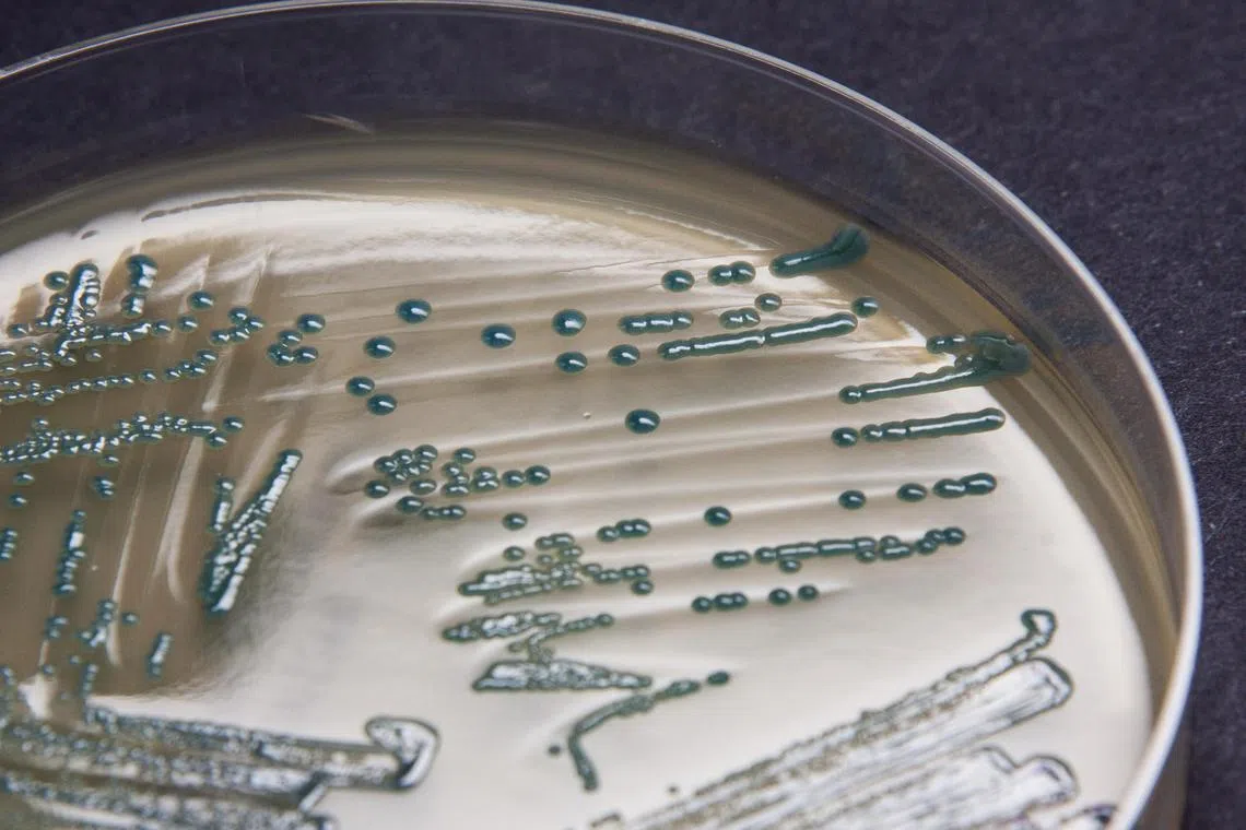 Colonies of carbapenem-resistant Enterobacteriaceae on a screening agar plate.