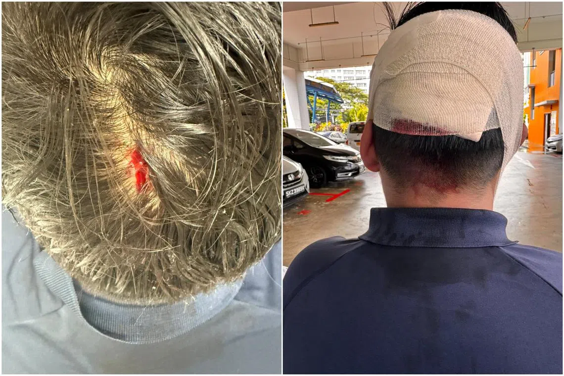 The school, Admiralty Secondary, said it is aware of the incident, which resulted in a cut on the victim’s head. 